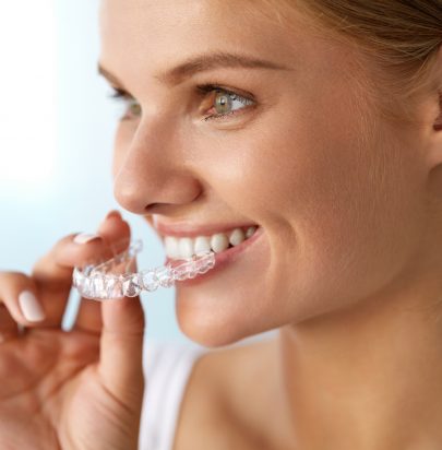 Adult Cosmetic Braces - Cirencester Dental and Aesthetics